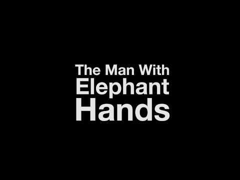 The Man With Elephant Hands fragman