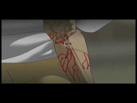 Technotise: Edit and I fragman