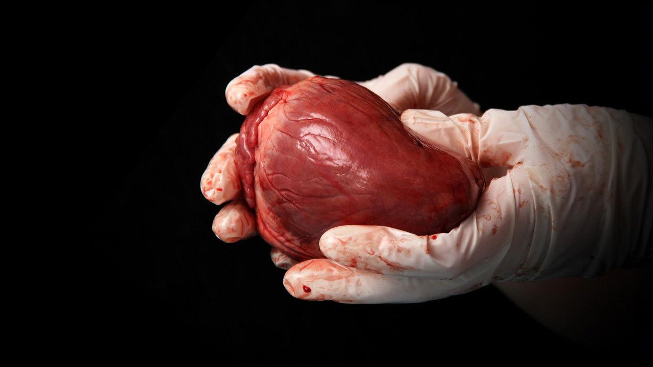 State Organs: Unmasking Transplant Abuse in China backdrop