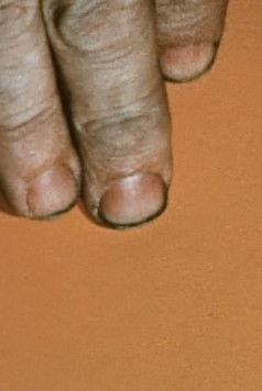 Color Aid film afişi