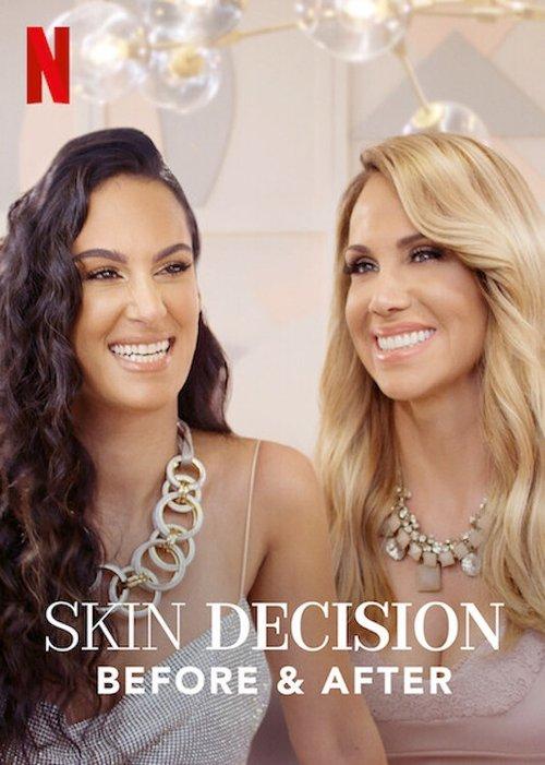 Skin Decision: Before and After dizi afişi