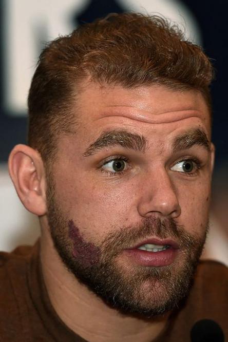 Billy Joe Saunders fotoğrafı