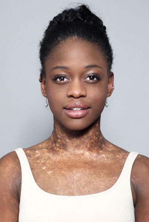 Michaela DePrince fotoğrafı