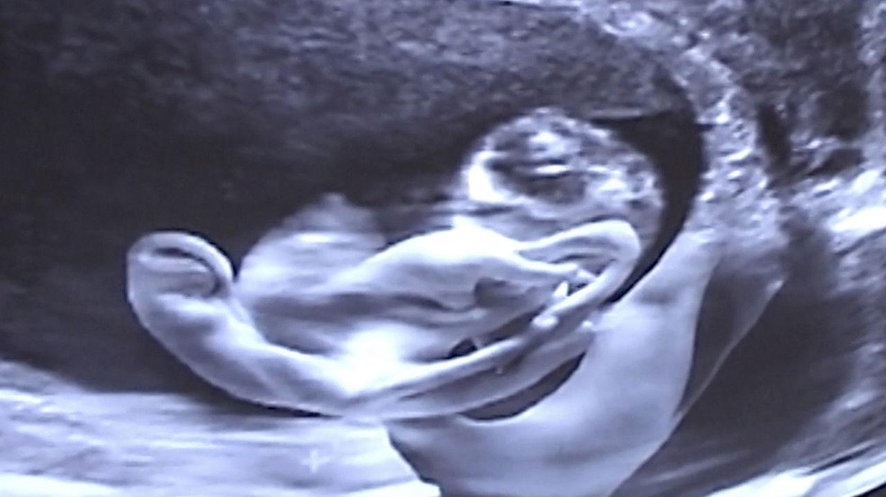 Castration Movie Anthology iii. Year of the Hyaena backdrop