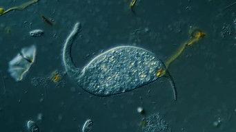 Dileptus: The Toxic Micro Elephant With an Insatiable Appetite