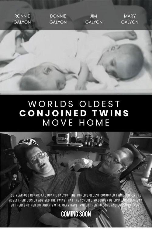 World's Oldest Conjoined Twins Move Home film afişi