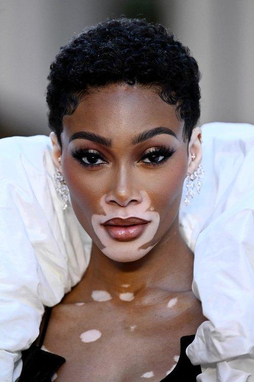 Winnie Harlow fotoğrafı